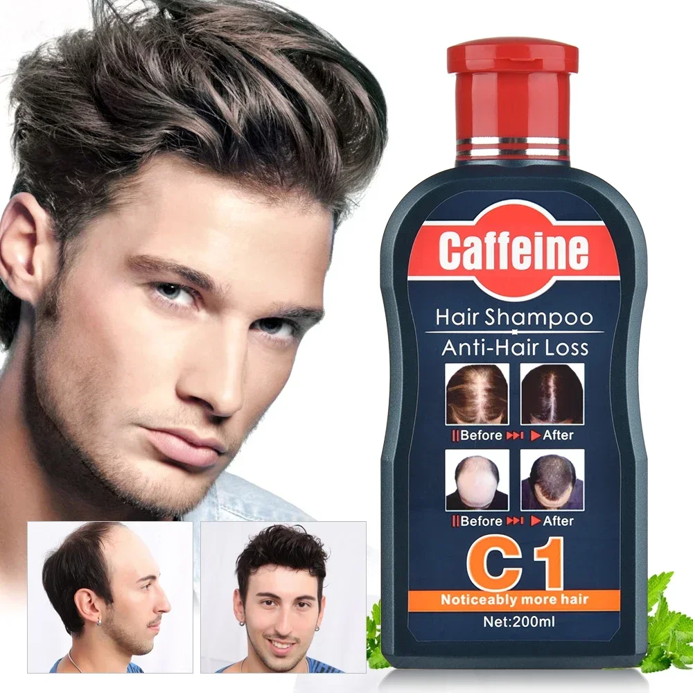 Men Shampoo For Hair Growth Na - Hair Care Korean Products ulasan dan harga